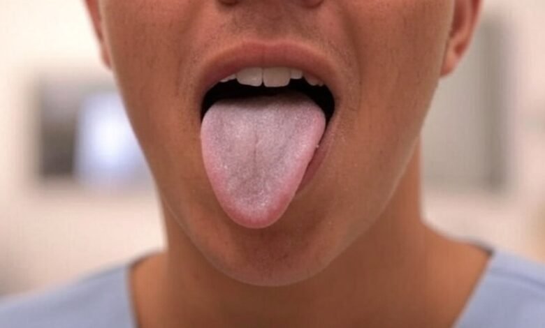 If your tongue is white, this is a clear sign that you are suffering from…