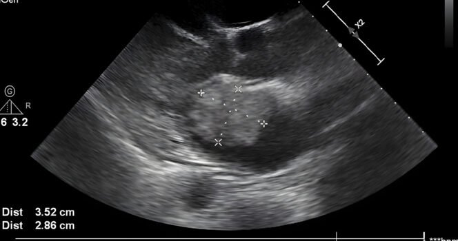 Mom spots ‘God’s hand’ cradling baby’s head in ultrasound