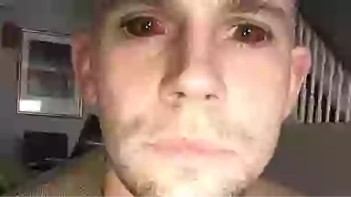 Man issues warning after five-day cocaine binge left him with ‘devil eyes’ and it almost killed him