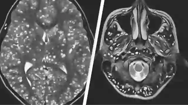 Terrifying study finds 30% of Americans could be infected with parasite that has horrific impact on brains