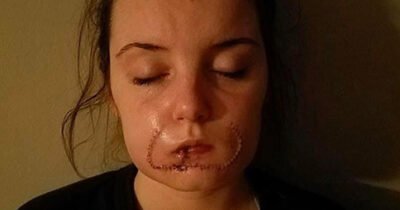 She thought it was love, but her ex left her scarred for life
