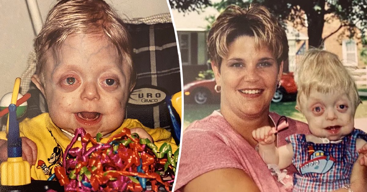 Teen who wasn’t expected to live 18 months graduates high school