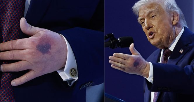 Expert issues warning and reveals exactly how long Donald Trump has ‘left to live’